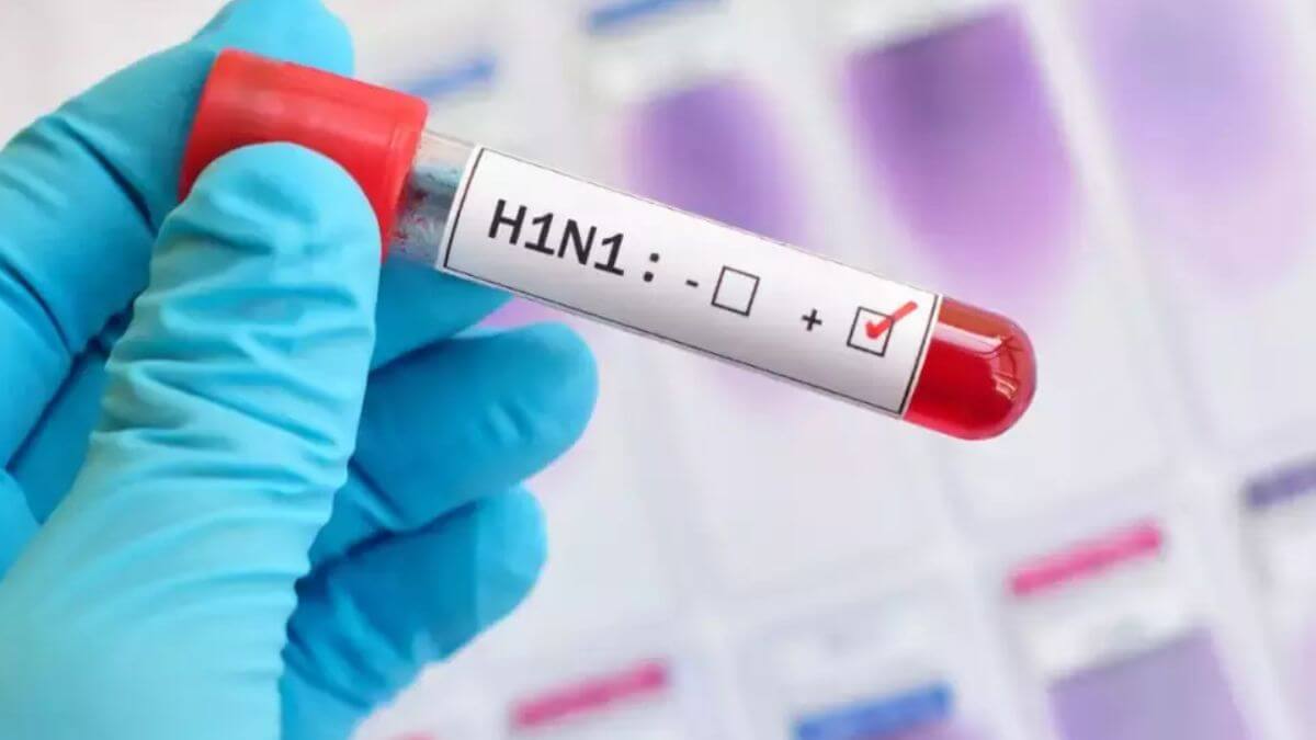 H1N1 Virus: Symptoms, Prevention, and Treatment Guide